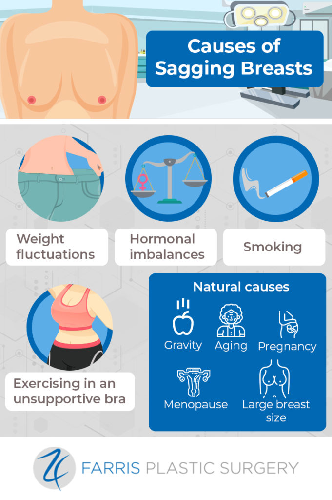 Causes of Sagging Breasts Infographic