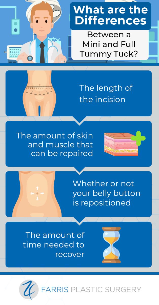 Full vs. Mini Tummy Tuck