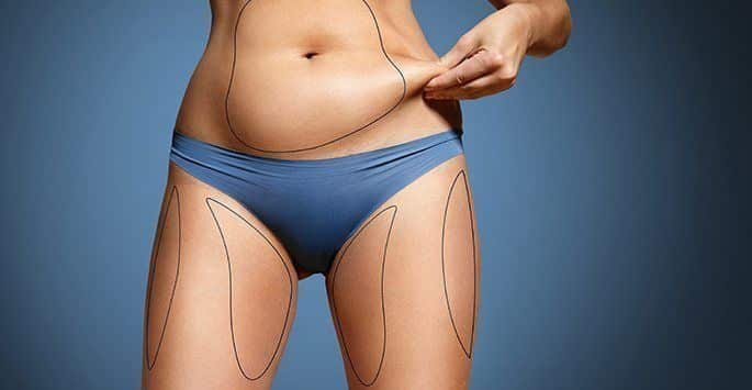 Fat Transfer and Tummy Tuck