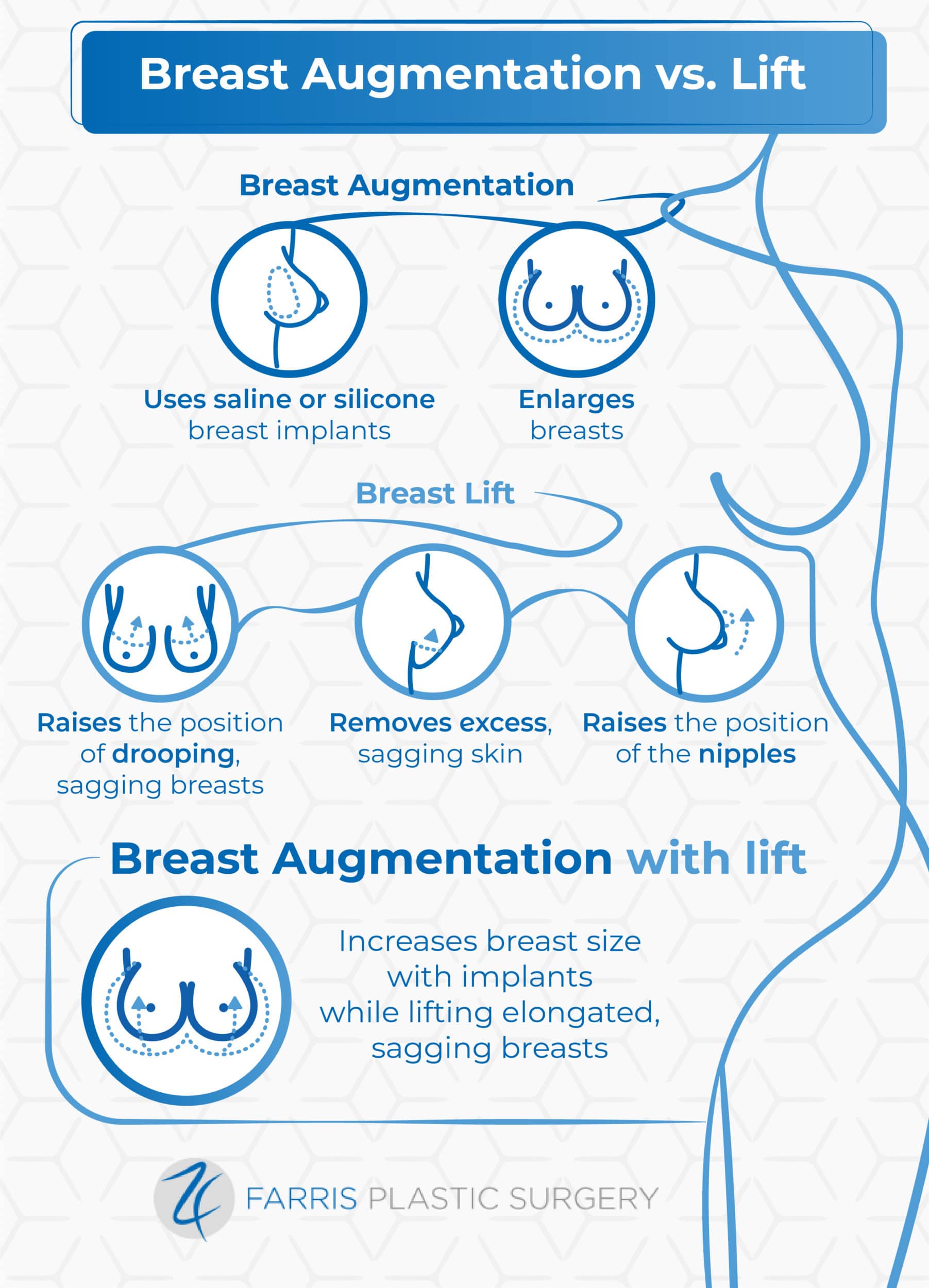 Breast Augmentation vs Lift
