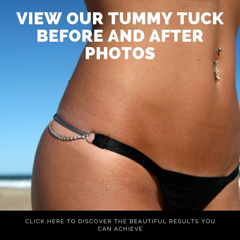 Tummy Tuck Plano TX