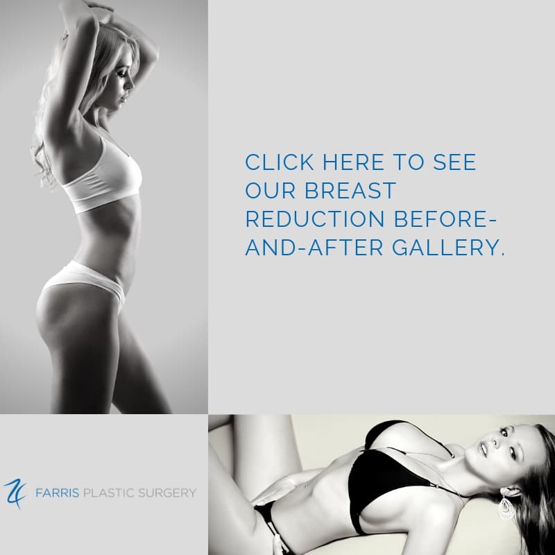 Breast Reduction surgeon Dallas TX