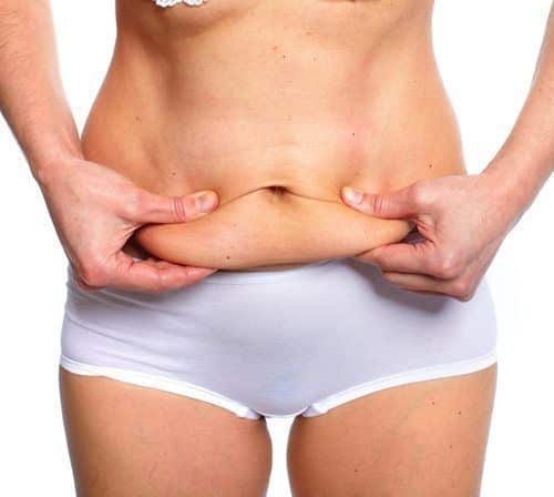 Cirugía del abdomen: ¿qué es la abdominoplastia? - Clínica Saint Paul