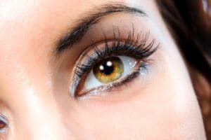 blepharoplasty Dallas TX