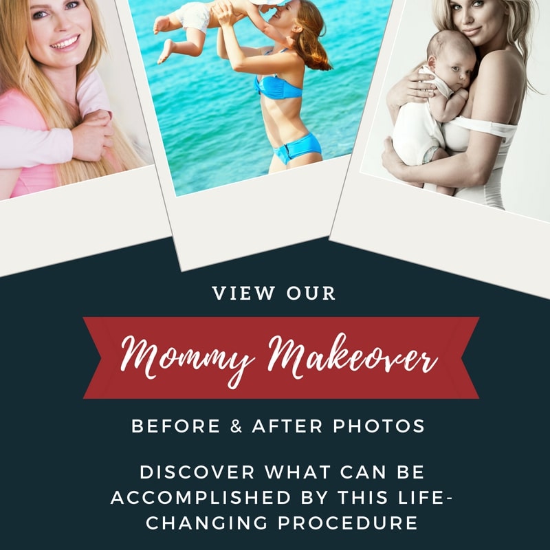mommy makeover before after photos