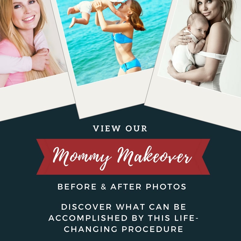 Mommy Makeover Surgeon Dallas TX