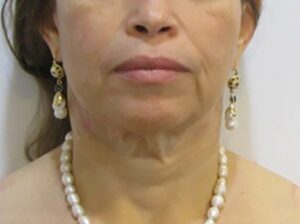 Before Image: Patient Case #2992