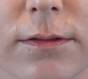 Before Image: Patient #1001