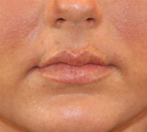 Before Image: Case #1002