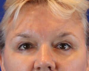 After Image: Patient Case #3068