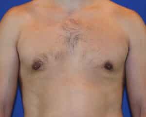 After Image: Patient Case #1053