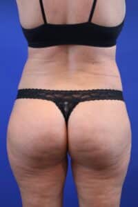 After Image: Patient Case #4010