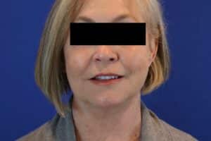 After Image: Patient Case #3621