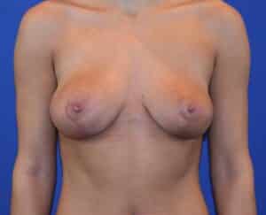 After Image: Patient Case #3865