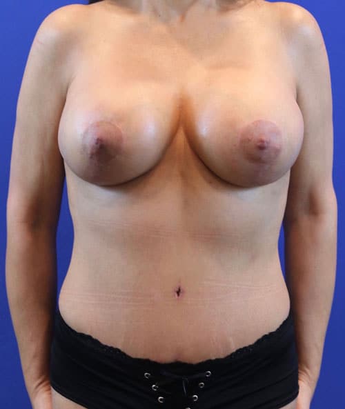 After Image: Patient Case #3008 -