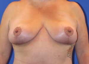 After Image: Patient Case #3868