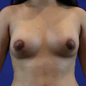 After Image: Patient Case #3654