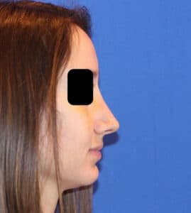 After Image: Case Patient 2