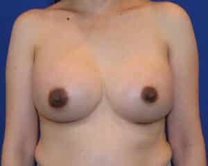After Image: Patient Case #3425