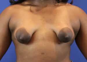 Before Image: Patient Case #3423