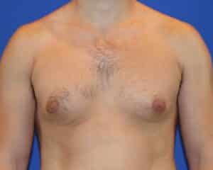 Before Image: Patient Case #1053