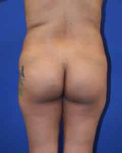 Before Image: Patient Case #4009
