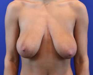 Before Image: Patient Case #3865