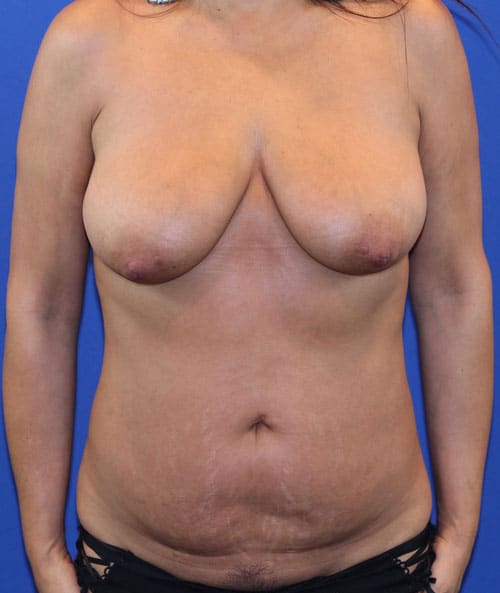 Before Image: Patient Case #3008 -