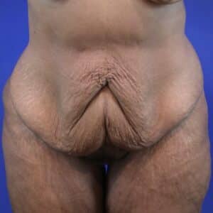 Before Image: Patient Case #3119