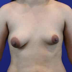 Before Image: Patient Case #3654