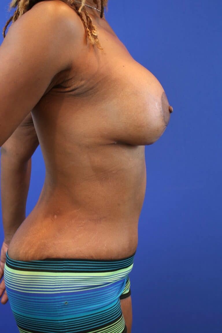 After Image: Patient Case #3221 -