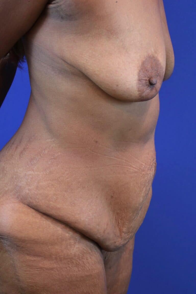 Before Image: Patient Case #3221 -
