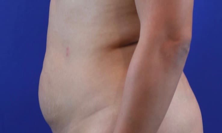 Before Image: Patient Case #3776 - left-side