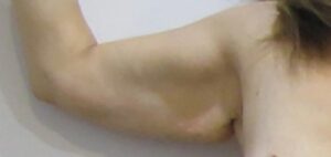 Before Image: Patient Case #1104