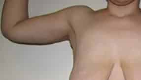 After Image: Patient Case #4847 - front
