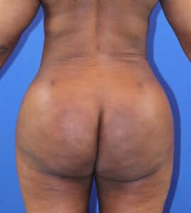 After Image: Patient Case #4005