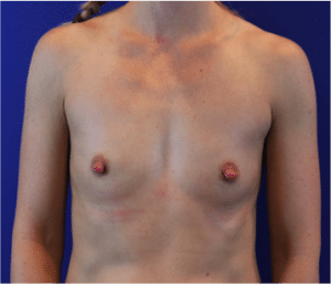 Before Image: Patient Case #3818