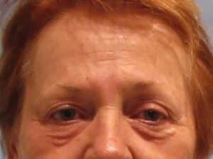 Before Image: Patient Case #3514