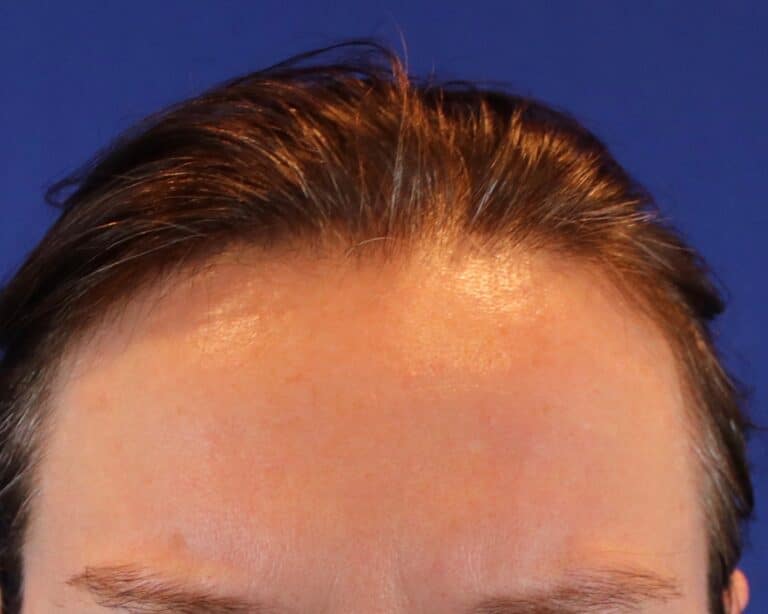 After Image: Case #490 - front