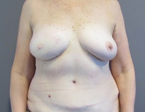 After Image