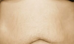 After Image: Patient Case #4198