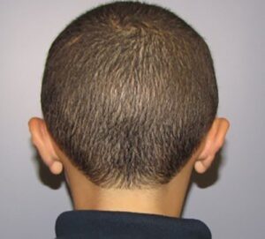 After Image: Patient Case #1201