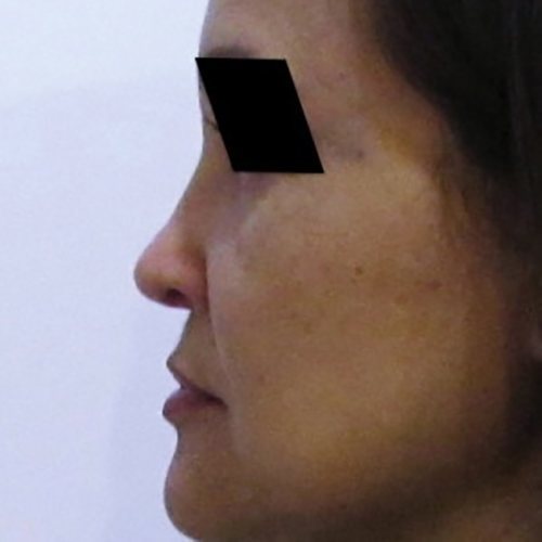 After Image: Case #0589 - left-side