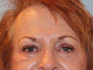 After Image: Patient Case #3514