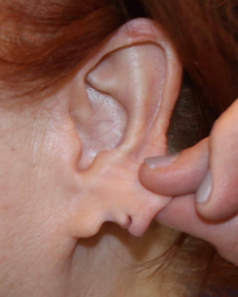Before Image: Patient 1 - other