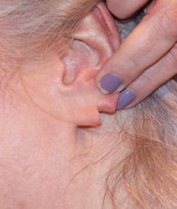 Before Image: Patient 2