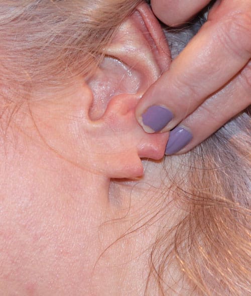 Before Image: Patient 2 - other