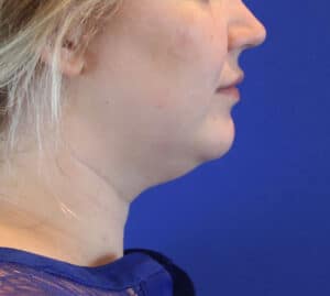 Before Image: Patient Case #3202