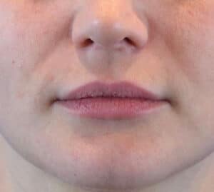 Before Image: Case #1004