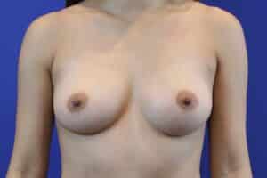 After Image: Patient Case #3190